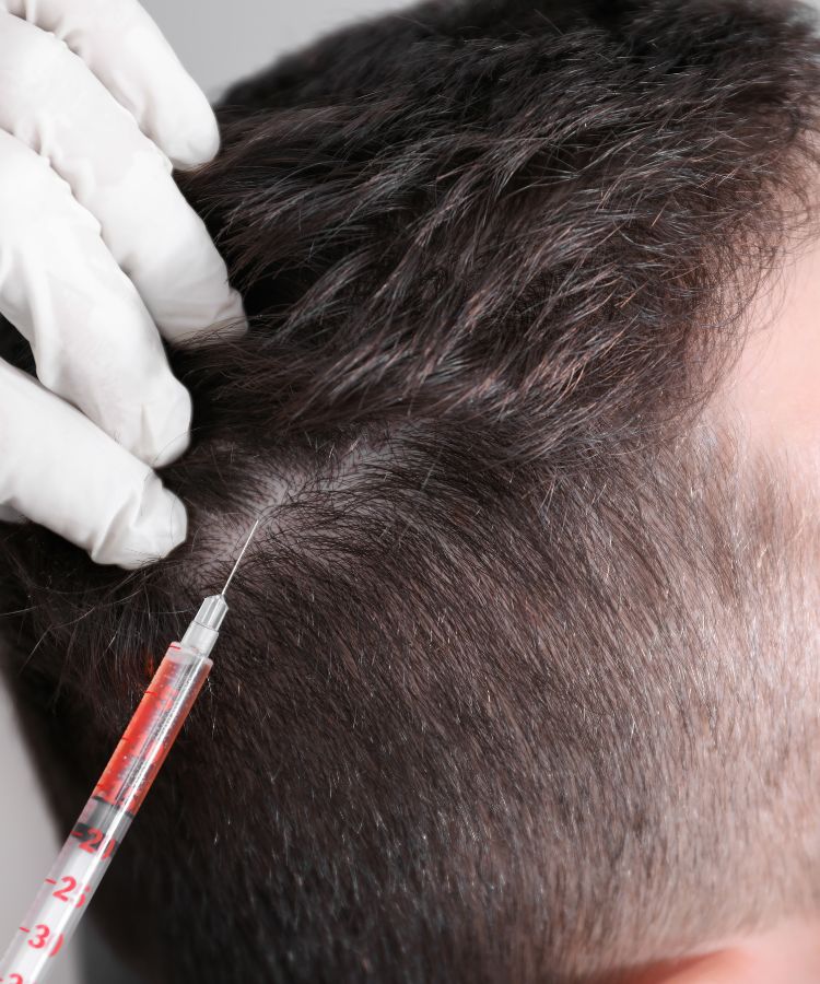 Especialista en Mesoterapia con Dutasteride