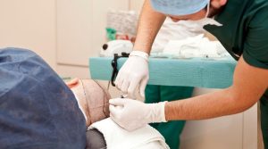 Mesoterapia Capilar
