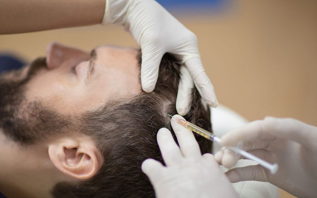 Mesoterapia Capilar en Zaragoza