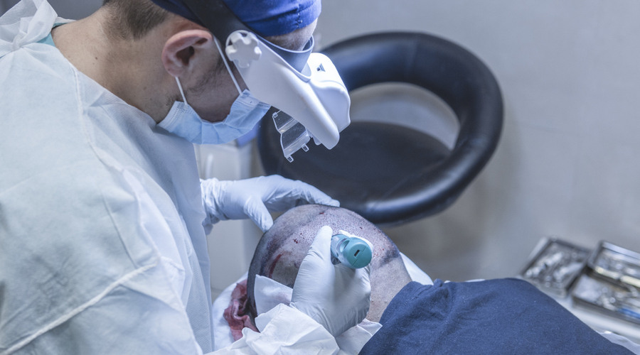 Mesoterapia con Dutasteride