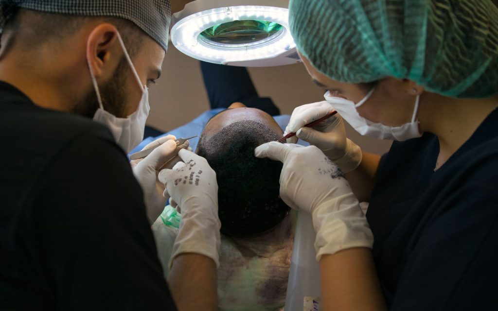 Equipo médico trabajando en el cuero cabelludo de un paciente durante un injerto capilar