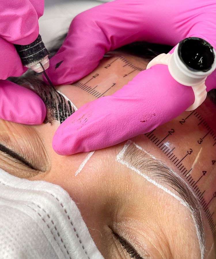 Proceso del Injerto de cejas