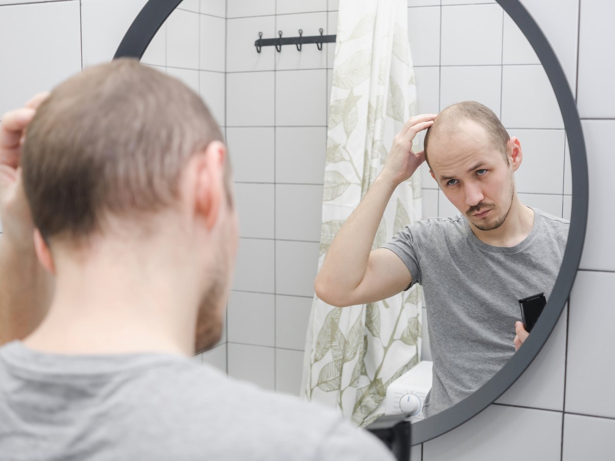 Hombre con entradas apartándose el pelo frente al espejo del baño para mirarse la línea frontal