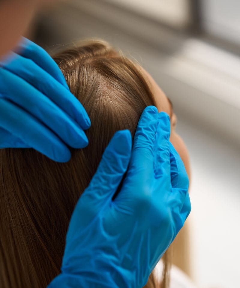 Especialista con guantes revisando el cabello de una mujer