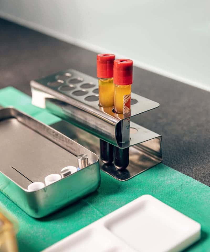 Tubos de sangre centrifugada con la capa de plasma separada